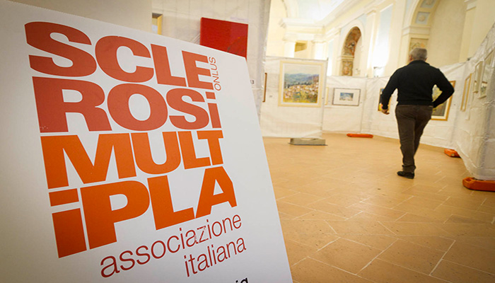 Sclerosi multipla, aumenta l’incidenza nel mondo e in Italia